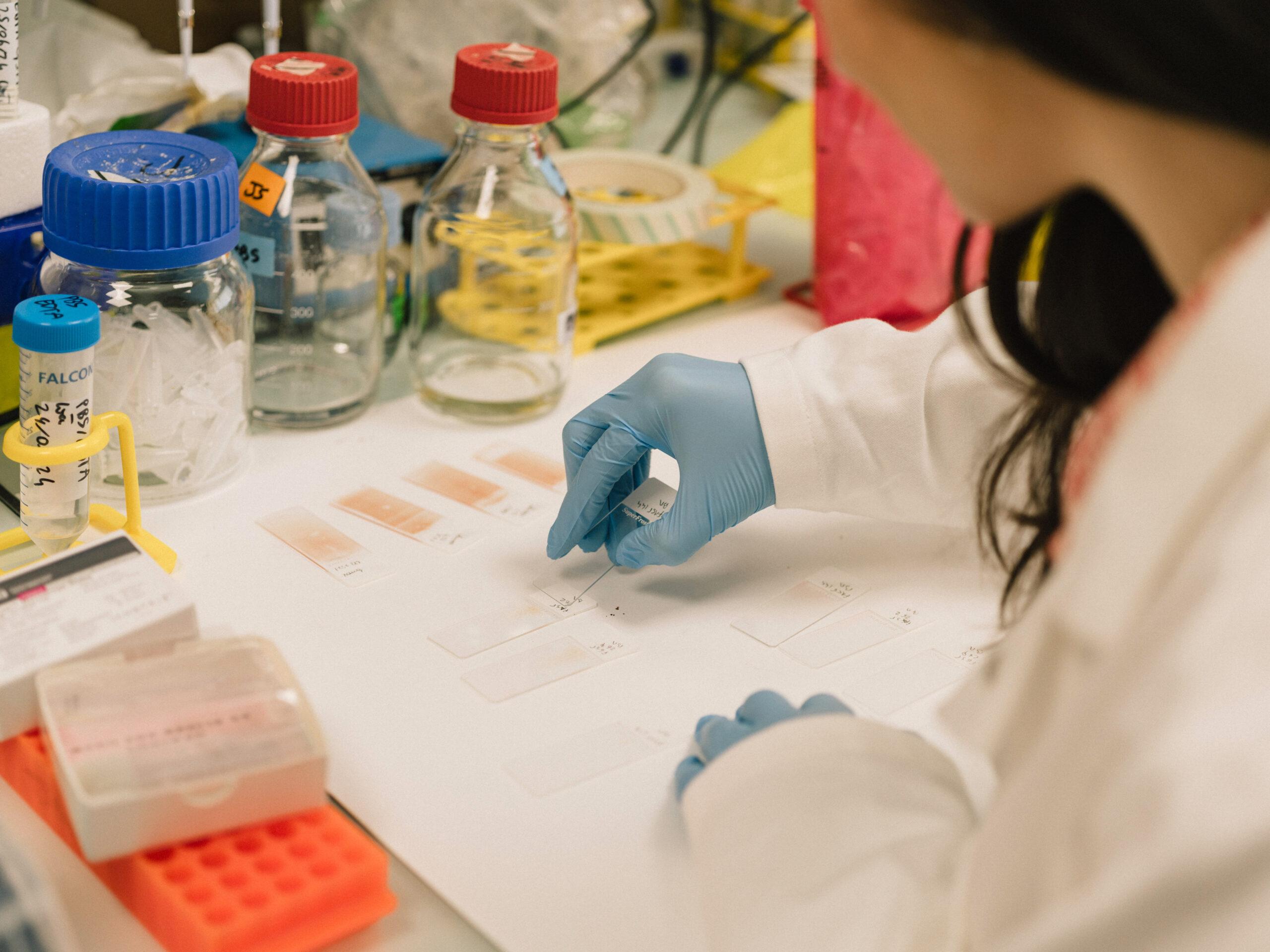 Service Hématologie Clinique
