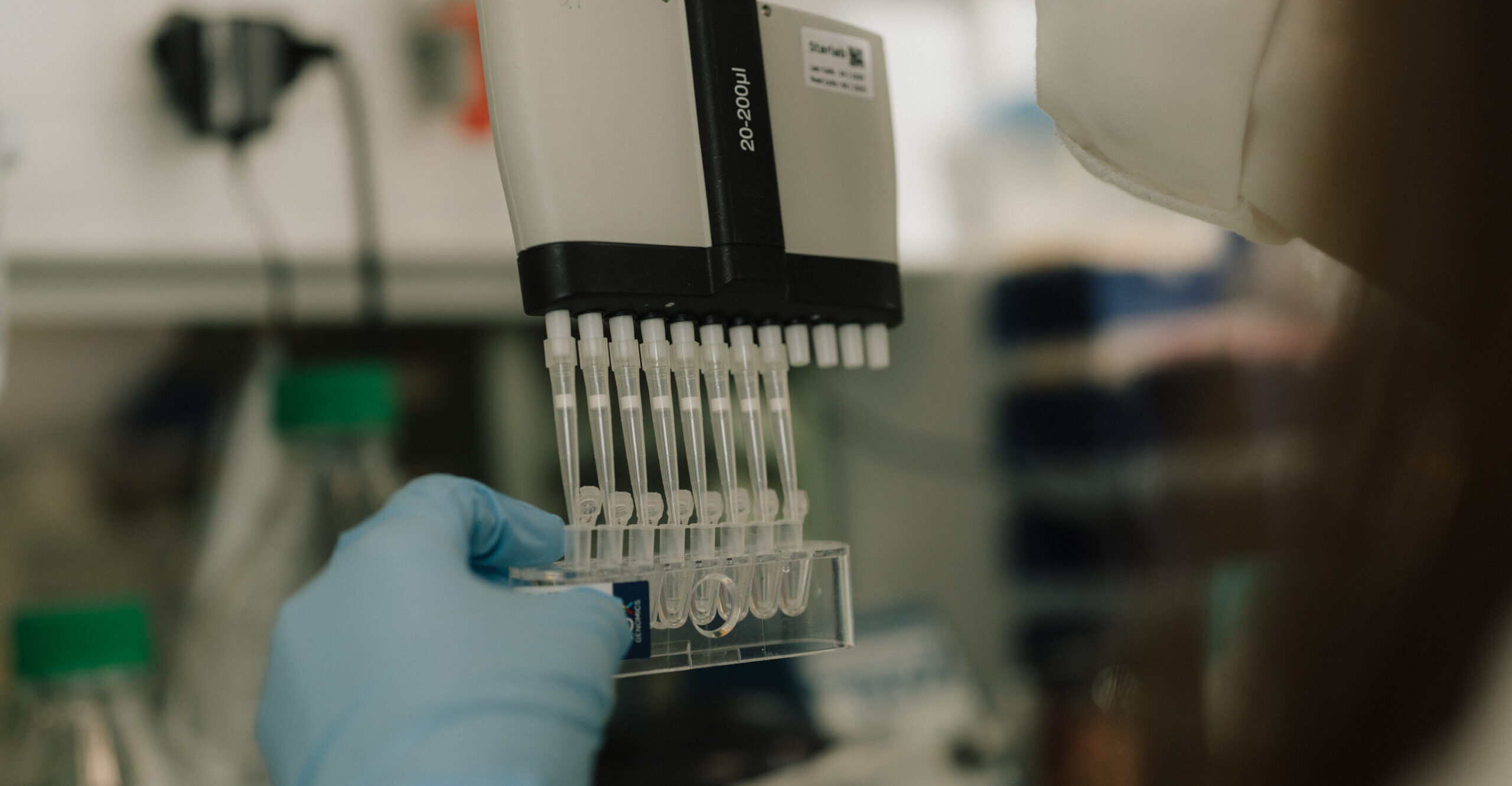 Leucémie et enfance : focus sur les avancées pédiatriques